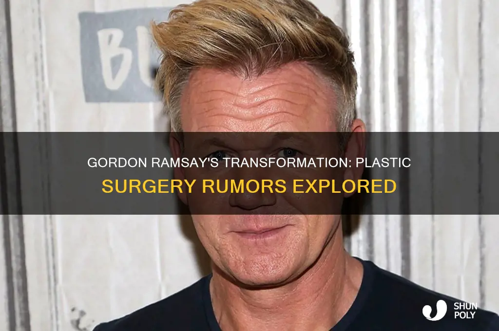 has gordon ramsey had plastic surgery