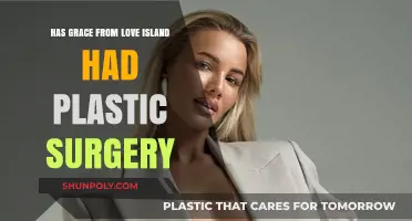 Grace from Love Island: Plastic Surgery Speculations and Truths