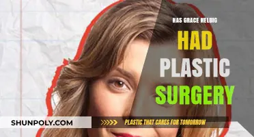 Grace Helbig's Transformation: Plastic Surgery Speculations and Truths