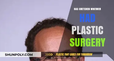 Gretchen Whitmer Plastic Surgery: Fact-Checking the Rumors and Speculations