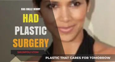 Halle Berry's Transformation: Plastic Surgery Rumors and Speculations Explored