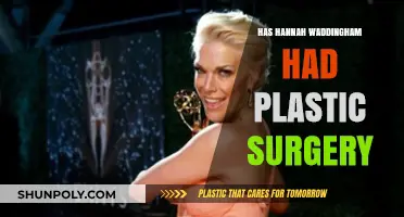 Has Hannah Waddingham Had Plastic Surgery? Unveiling the Truth