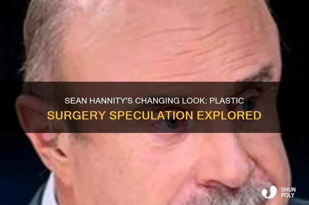 has hannity had some facial plastic surgery