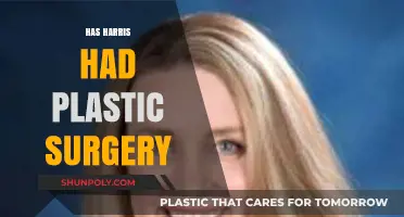 Has Harris Had Plastic Surgery? Uncovering the Truth Behind the Rumors