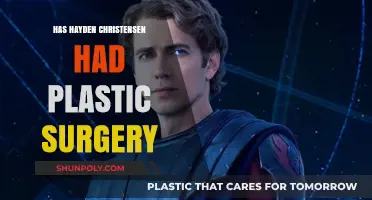 Hayden Christensen's Transformation: Plastic Surgery Rumors Explored
