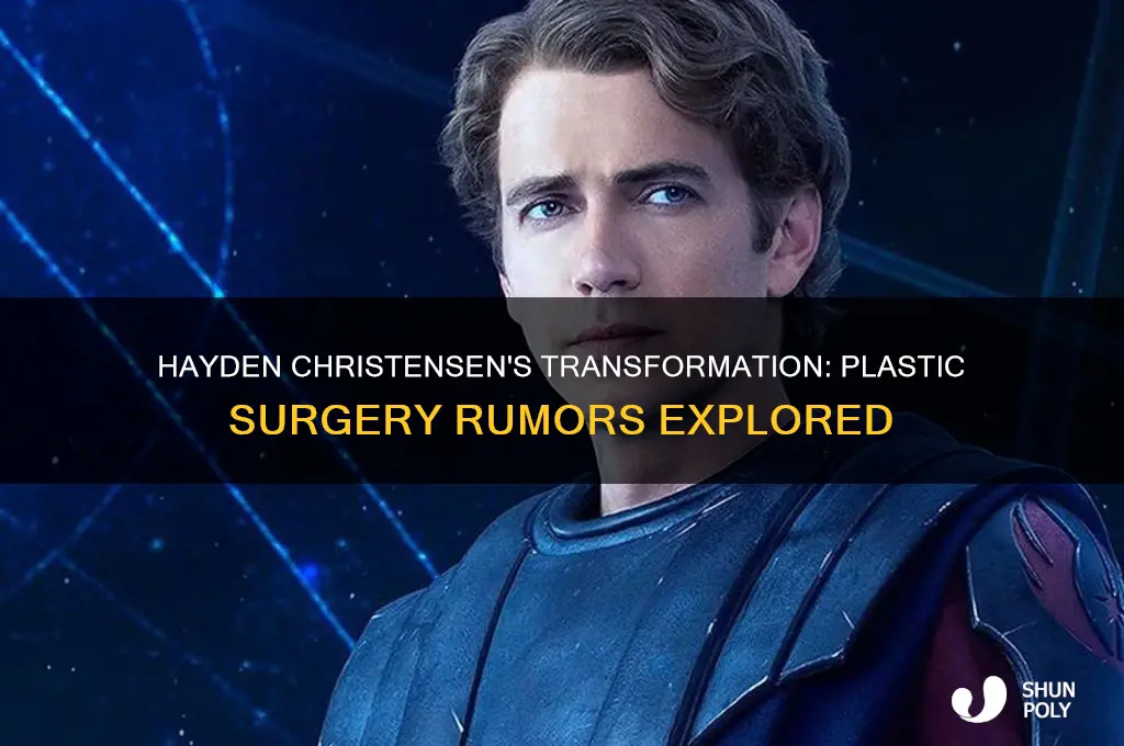 has hayden christensen had plastic surgery