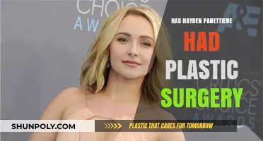 Hayden Panettiere's Transformation: Plastic Surgery Rumors Explored