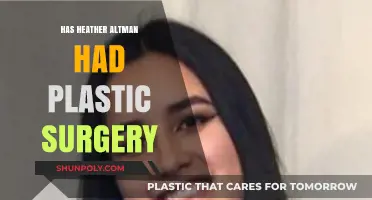 Heather Altman Plastic Surgery: Fact-Checking the Rumors and Speculations