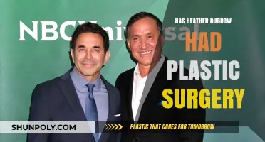 Heather Dubrow's Transformation: Plastic Surgery Speculations and Truths Revealed
