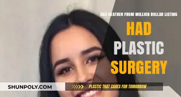 Heather Million Dollar Listing Plastic Surgery: Fact or Fiction?