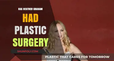 Heather Graham Plastic Surgery: Fact-Checking the Rumors and Speculations