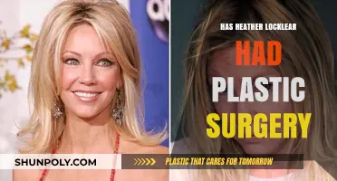 Heather Locklear's Transformation: Plastic Surgery Speculations and Truths