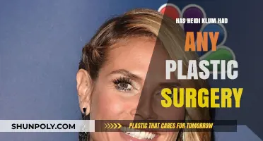 Heidi Klum's Transformation: Plastic Surgery Rumors and Reality Revealed