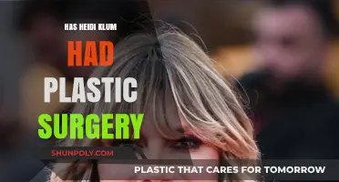 Has Heidi Klum Had Plastic Surgery? Uncovering the Truth