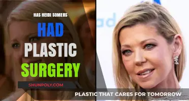 Heidi Somers Plastic Surgery: Fact-Checking the Fitness Influencer's Transformation