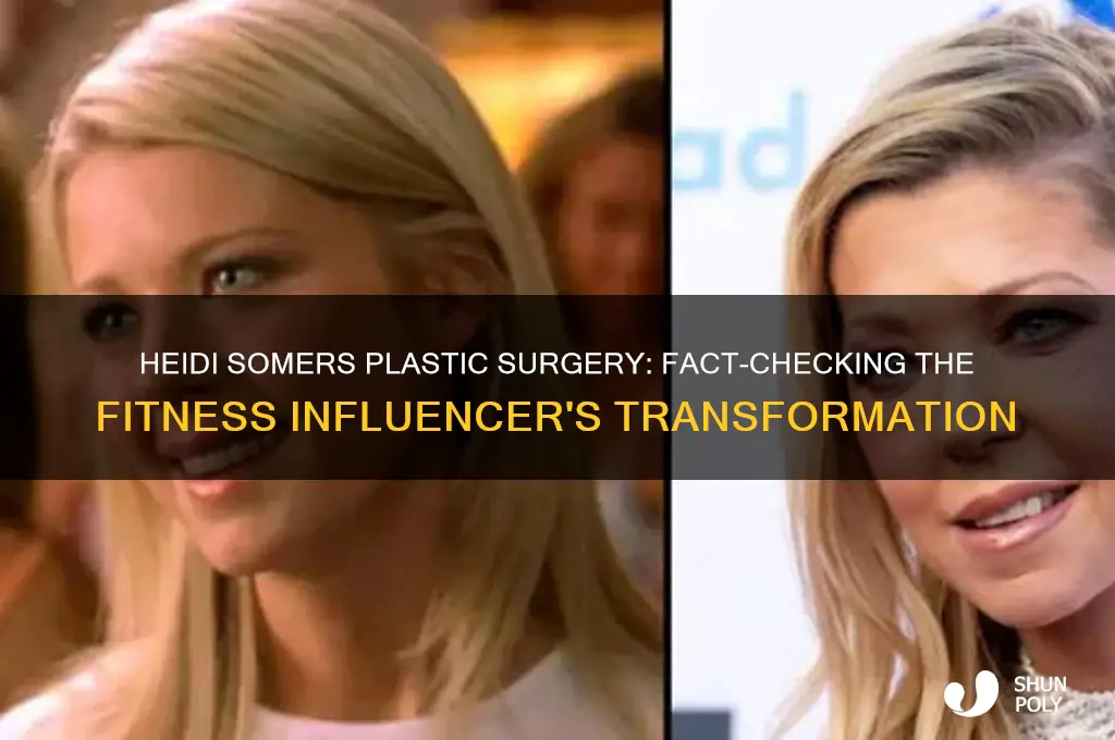 has heidi somers had plastic surgery