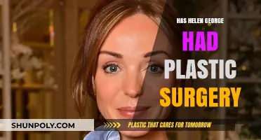 Helen George Plastic Surgery: Fact-Checking the Rumors and Speculations