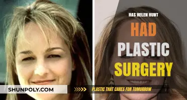 Helen Hunt Plastic Surgery: Fact-Checking the Rumors and Speculations