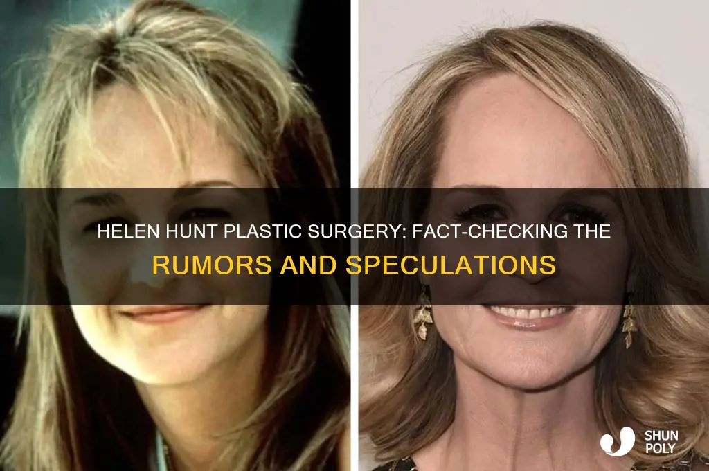 has helen hunt had plastic surgery