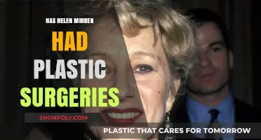 Helen Mirren's Ageless Beauty: Plastic Surgery Speculations Explored