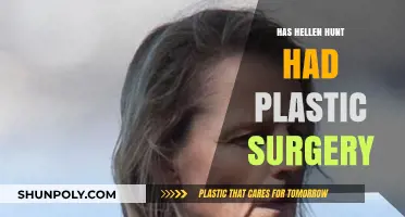 Helen Hunt Plastic Surgery: Fact-Checking the Actress' Transformation Rumors