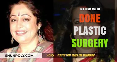 Hema Malini Plastic Surgery: Fact-Checking the Rumors and Speculations