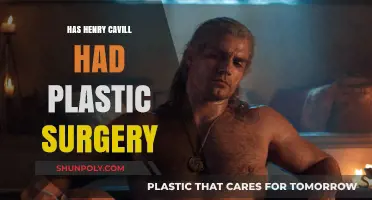 Henry Cavill's Transformation: Plastic Surgery Rumors Explored