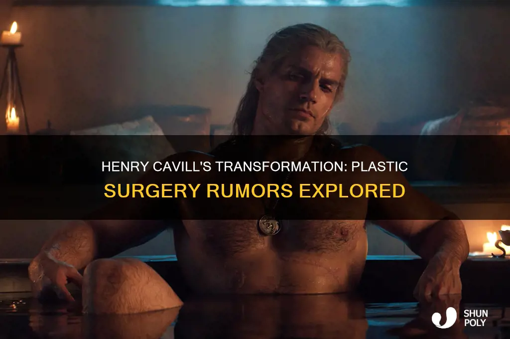 has henry cavill had plastic surgery