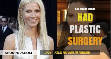 Has Hilary Swank Had Plastic Surgery? Unveiling the Truth