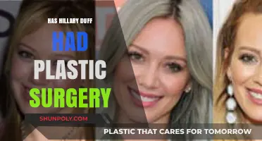 Hillary Duff's Transformation: Plastic Surgery Rumors and Reality Revealed
