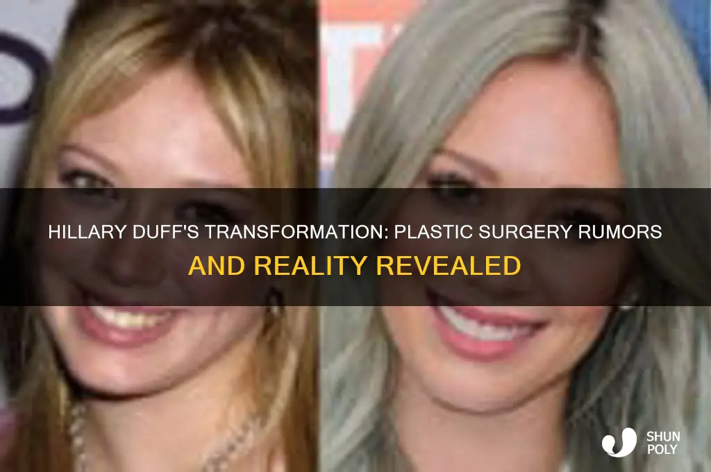 has hillary duff had plastic surgery