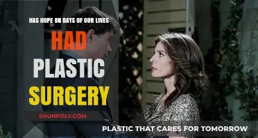 Has Hope Brady from Days of Our Lives Had Plastic Surgery?