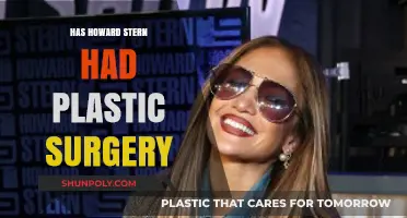 Howard Stern's Transformation: Plastic Surgery Rumors Explored
