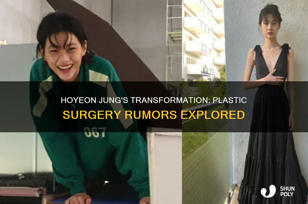 has hoyeon jung had plastic surgery