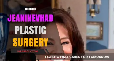 Did Judge Jeanine Pirro Undergo Plastic Surgery? Uncovering the Truth