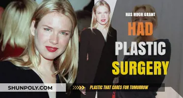 Has Hugh Grant Had Plastic Surgery? Unveiling the Truth