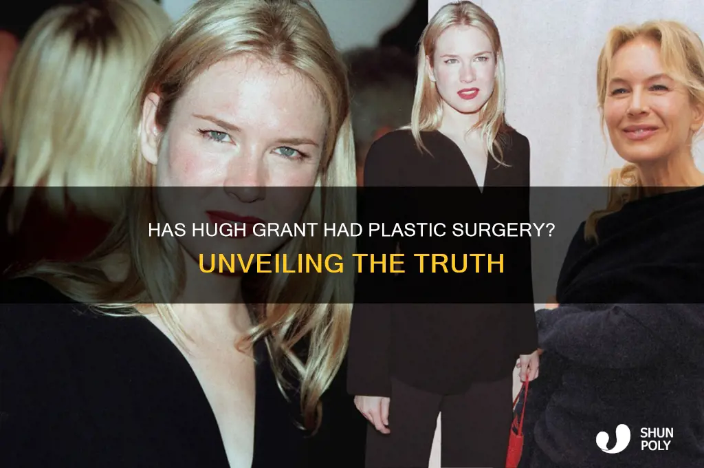 has hugh grant had plastic surgery