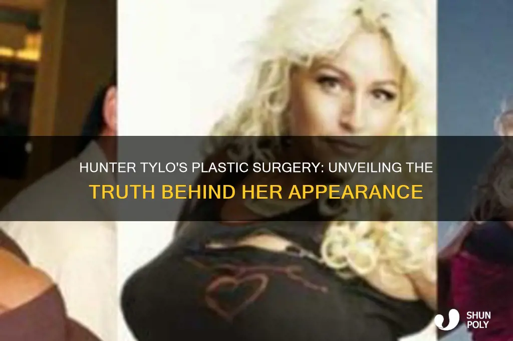 has hunter tylo had bad plastic surgery