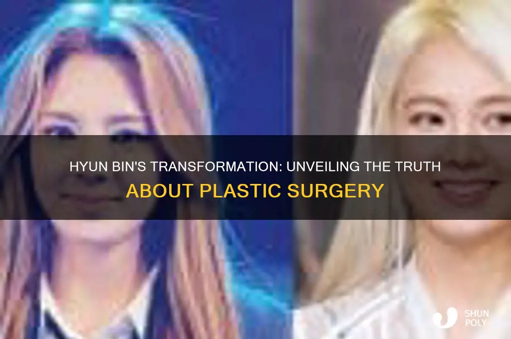 has hyun bin had plastic surgery