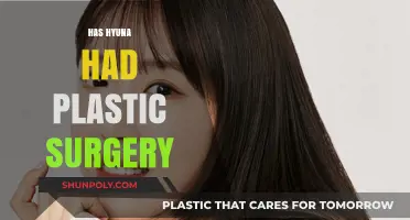 Hyuna's Transformation: Unveiling the Truth About Her Plastic Surgery Rumors