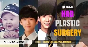 Hyunjin's Transformation: Uncovering the Truth About Plastic Surgery Rumors