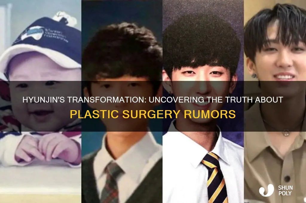 has hyunjin had plastic surgery
