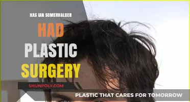 Ian Somerhalder's Transformation: Plastic Surgery Rumors Explored