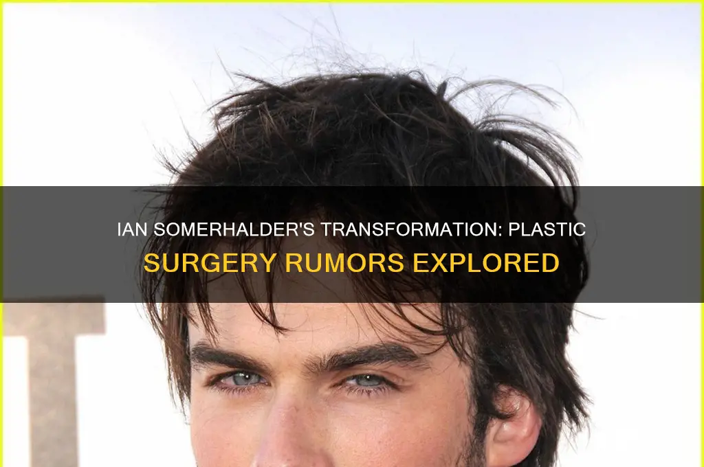 has ian somerhalder had plastic surgery