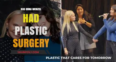 Idina Menzel's Transformation: Plastic Surgery Rumors and Reality