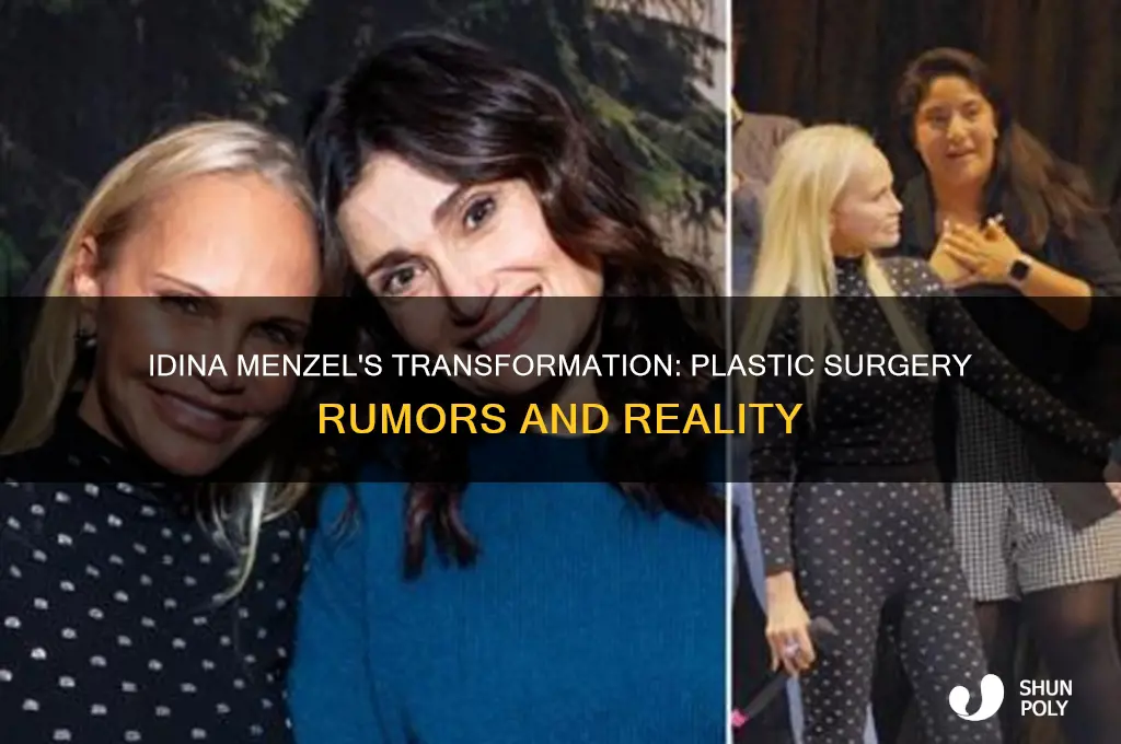 has idina menzel had plastic surgery