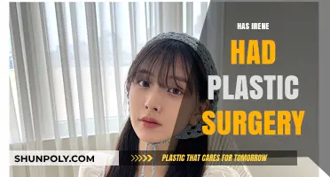 Irene's Transformation: Unveiling the Truth About Plastic Surgery Rumors