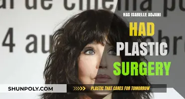 Isabelle Adjani's Changing Looks: Plastic Surgery Speculations Explored