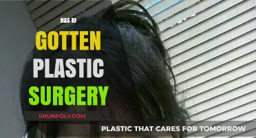 IU's Transformation: Unveiling the Truth About Plastic Surgery Rumors