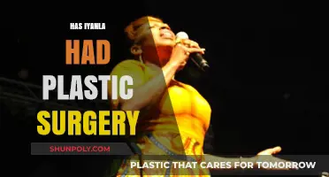Iyanla Vanzant's Transformation: Plastic Surgery Speculations and Truths Revealed